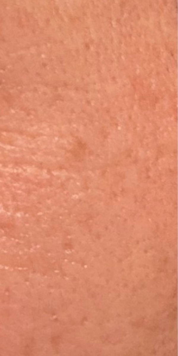After image
